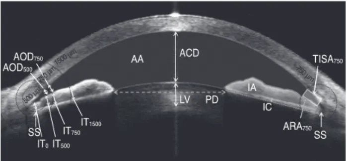 Fig. 1. Anterior segment parameters measured by anterior seg- seg-ment optical coherence tomography and calculated using the  Image J software ver