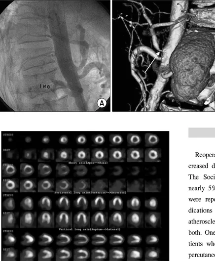 Fig. 1. (A) Abdominal aortography  demonstrating no celiac axis stenosis  before the initial surgery