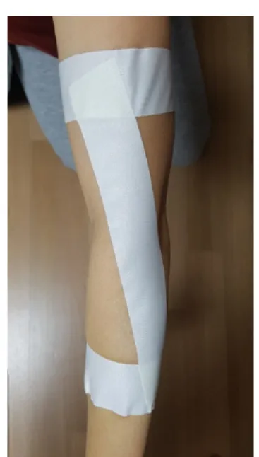 Fig. 1. Elastic taping. Fig. 2. Non-elastic taping.