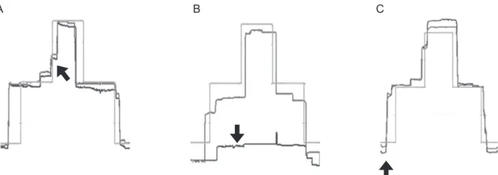 Fig. 1. Possible errors during the test. (A) Wrong detection of inflection point, (B) missing movement, and (C) prediction.