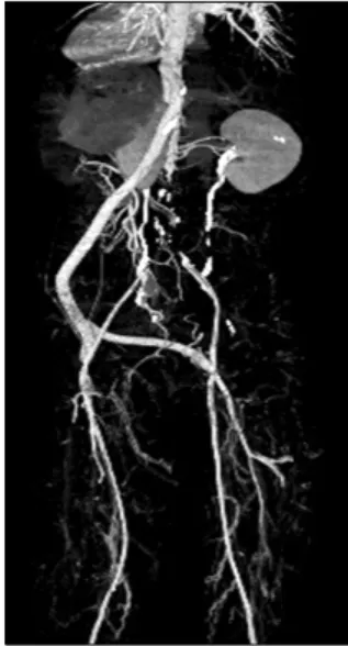 Fig. 1. Preoperative computed tomography angiography. Fig. 2. Postoperative computed tomography angiography.