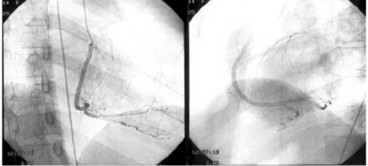 Fig.  1.  Cerebral  artery  anglogram