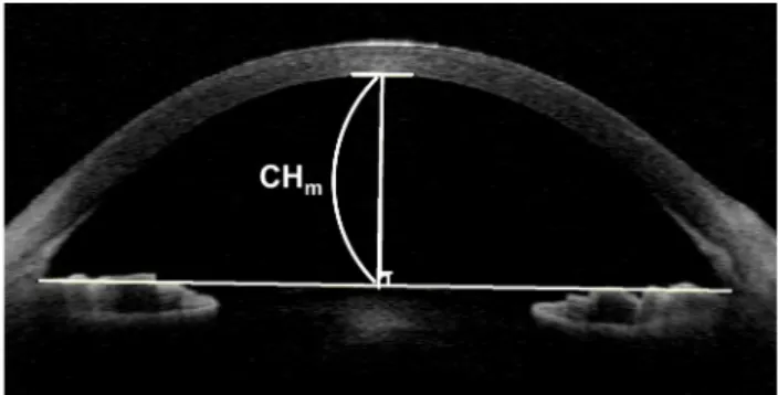 Fig. 1. An anterior segment optical coherence tomography image. 
