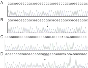 Fig. 3. DNA sequence analysis of the forkhead box C1 gene. (A,  C) The reference sequences derived from a normal subject are  shown