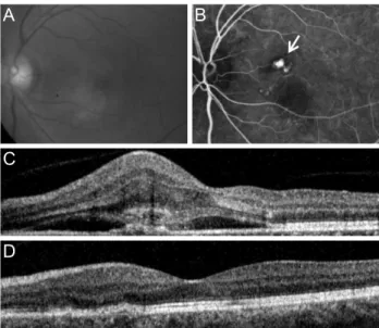 Fig. 2 illustrates representative cases of eyes from the  hemorrhage and non-hemorrhage groups