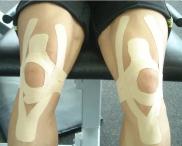 Table  1.  Contents  of  exercise  program Fig  1.  Taping  on  the  knee  joint