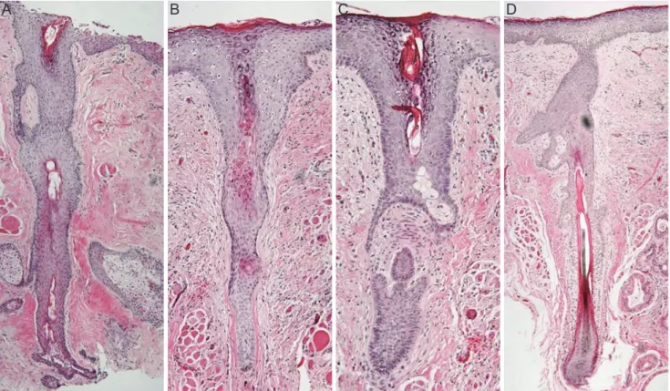 Fig. 3. Optical microscopic findings revealed structural damage in all four follicles
