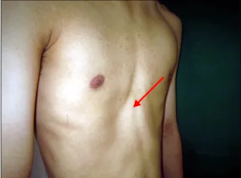 Fig. 3. Postoperative picture.