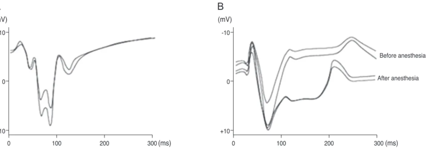 Fig. 3. Visual evoked potentials (VEPs) to the flash stimuli for the controlled object