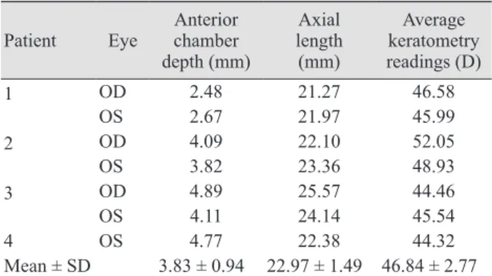 Table 1. Modification of Gills’ nomograms to predict refrac- refrac-tive change after temporary intraocular lens removal