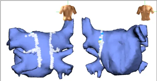 Fig. 2. Axial brain magnetic resonance image shows multiple in- in-farcts (arrows).