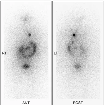 Fig. 3. Intraoperative findings.