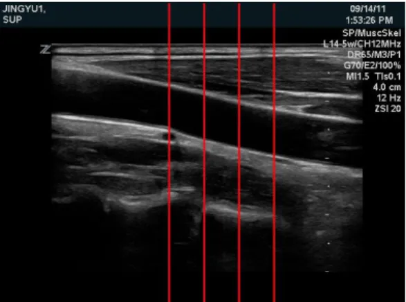 Fig  1.  NIH  Image  J  software