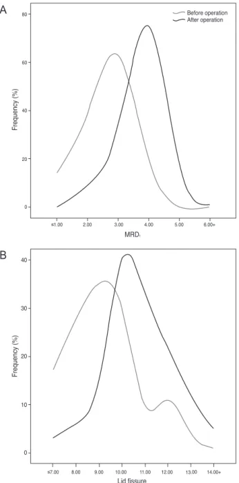 Fig. 4. (A) Margin reflex distance (MRD 1 ) distribution before and  after surgery. (B) Lid fissure distribution before and after surgery.