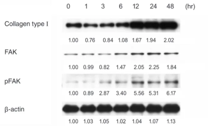 Fig. 3. Representative Western immunoblots and densitometric  data for α smooth muscle actin (43 kDa) in human Tenon’s  fi-broblasts stimulated by 5 ng/mL of transforming growth factor  (TGF)-β1 for up to 48 hours with or without the treatment of  siRNA ta