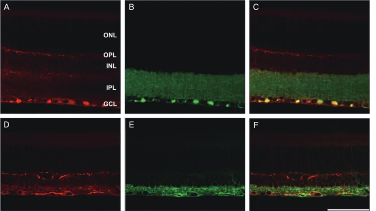 Fig. 3. Confocal micrographs taken from a vertical section of normal retina (A,B,C) and ischemic retina 2 weeks after injury (D,E,F)