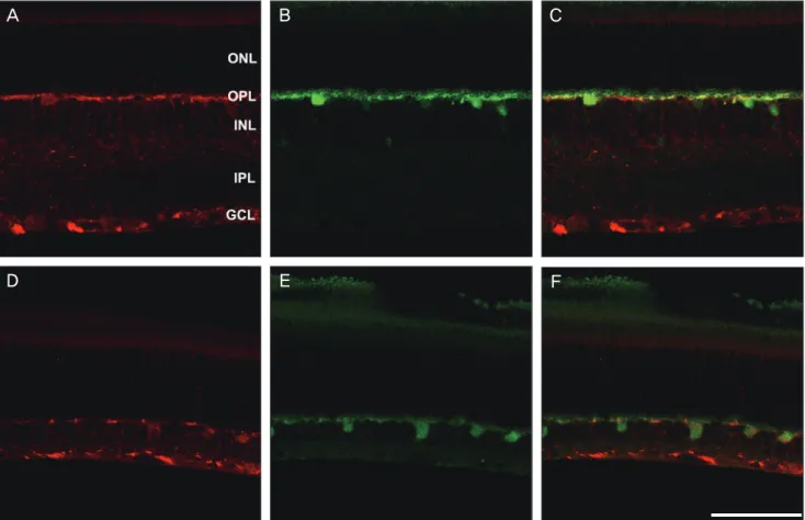 Fig. 4. Confocal micrographs taken from a vertical section of normal retina (A,B,C) and ischemic retina 2 weeks after injury (D,E,F)