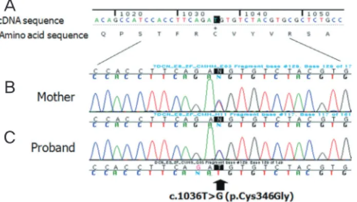 Fig. 6. Mutation analysis of the decorin gene. Partial sequence  chromatograms displaying the wild-type DNA sequence of an  unaffected person (A) and the DNA sequence of the mother (B)  and patient (C), who were heterozygous for the decorin c.1036T  point 