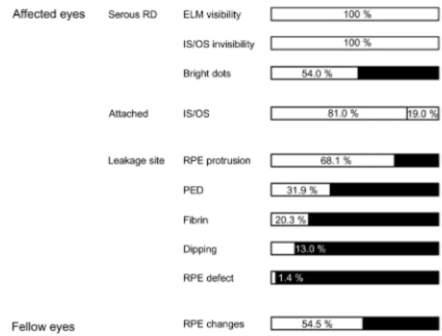 Fig. 6. Simultaneous imaging of indocyanine green angiography  (ICGA) and spectral domain optical coherence tomography in  asymptomatic fellow eyes