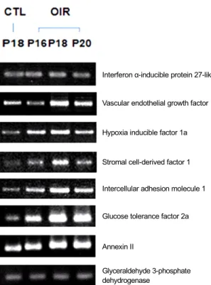 Fig. 2. Up-regulated genes of oxygen-induced retinopathy (OIR) rat  retina in reverse transcriptase polymerase chain reaction