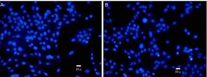 Fig. 2. Hoechst staining. (A) The control group, which was not exposed to ultraviolet irradiation, showed normal nuclei appearance without  nuclear fragmentation