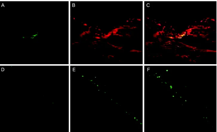 Fig. 3. Confocal microscope images of the laser-induced retinotomy site in a continuous section at five and seven weeks after mesen- mesen-chymal stem cells (MSCs) transplantation (A-C, ×200; D, ×100; E, ×200; F, ×400)