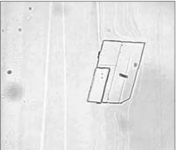 Fig. 2. Microscopic analysis of unprocessed aqueous humor aspi- aspi-rate disclosed transparent rhomboidal crystals with notched corners  that are typical of cholesterol.