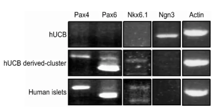 Fig.  4.  Gene  expression  pattern  by  RT-PCR:  The  expression  of  Pax4,  Pax6,  and  Nkx6.1were  increased  and  Ngn3  was  decreased  in  hUCB  derived-cluster  cultures.