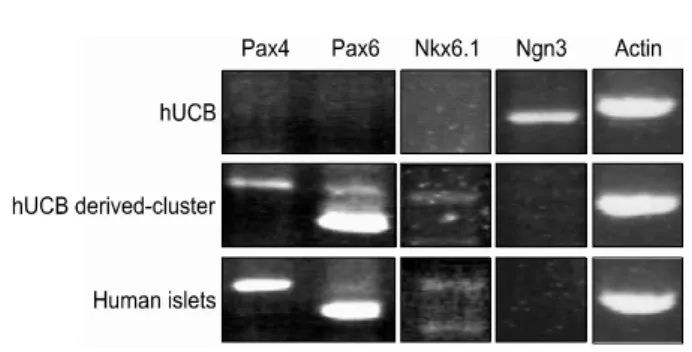 Fig.  4.  Gene  expression  pattern  by  RT-PCR:  The  expression  of  Pax4,  Pax6,  and  Nkx6.1were  increased  and  Ngn3  was  decreased  in  hUCB  derived-cluster  cultures.