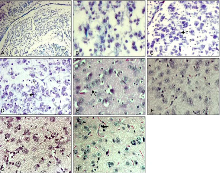 Fig. 1. The morphological assessment. (A) Control group (immediately after birth). Lateral geniculate body is composed of small un- un-differentiated neurons which form short cellular cords scattered within the nucleus