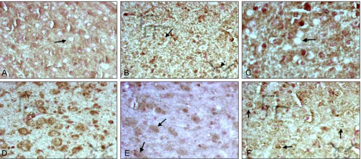 Fig. 2. The immunohistochemical assessment. (A) Control group (1 week after birth). No c-Fos immunoreactivity was observed in the nucleus  (arrow)