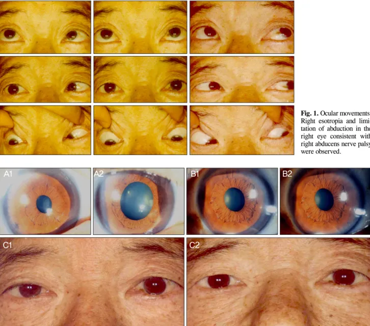 Fig. 1. Ocular movements. 
