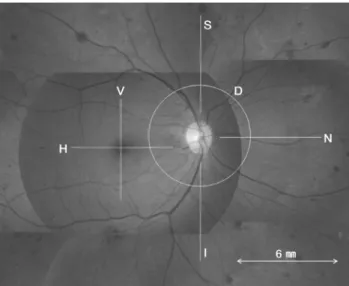 Fig.  1. Optic coherence tomography scans were performed at the  macula and peripapillary zones, indicated by the line superimposed  on the fundus photograph