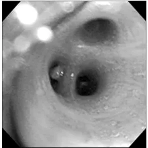 Fig. 2. Pathological examination. (A) The specimen shows ruptured vascular structures (H&amp;E, ×40)
