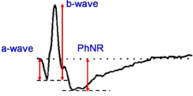 Fig. 1. Characteristic waveform of a photopic negative response  (PhNR). The PhNR is the slow negative potential following the  b-wave in photopic electroretinography.