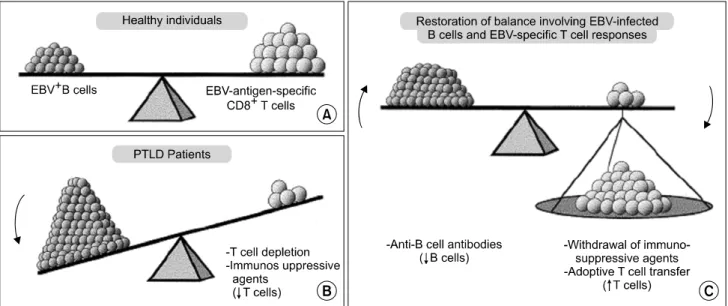Fig.  3.  Balance  between  EBV-infected  B  cells  and  EBV-specific  T  cells.  (A)  In  healthy  individuals;  (B)  in  patients  with  PTLD;  (C)  patients  in  whom  B  cell  numbers  have  been  reduced  or  T  cell  responses  have  been  augmented.