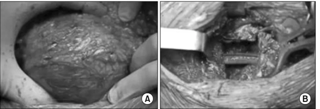 Fig. 2. Preoperative computed tomography scan.