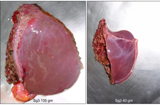 Fig. 1. The  photography  of  the  procured  graft.
