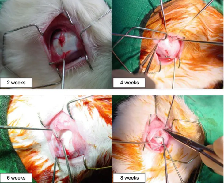 Fig. 1. In the recession group, there was no change in the recessed SO tendon position in all 16 eyes through postoperative week eight.