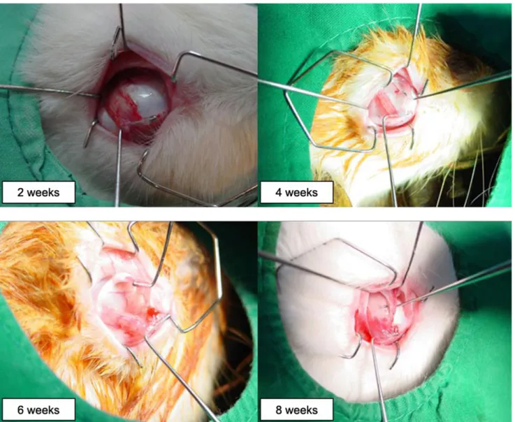 Fig. 2. In the tenotomy group, there were no visible cut ends of the SO tendons at postoperative week two in all four eyes (left upper)