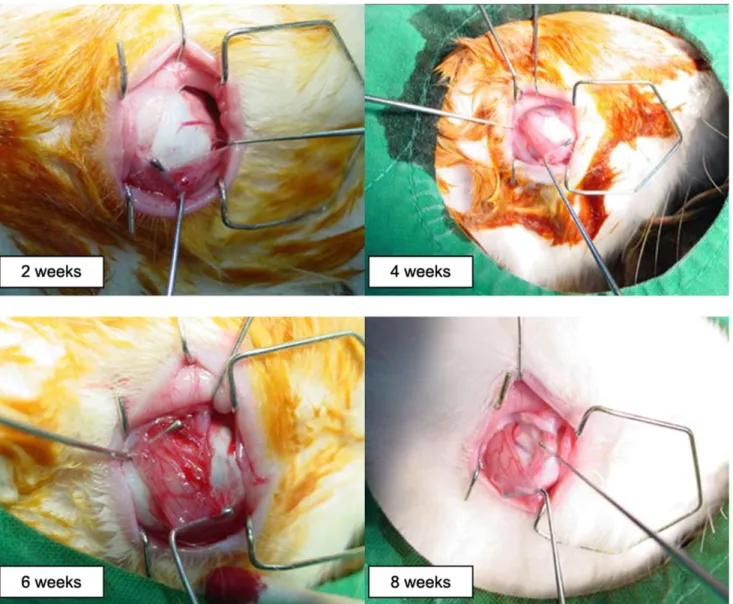 Fig. 3. In the tenectomy group, there were no visible cut ends of the SO tendons at postoperative week two in all four eyes (left upper)