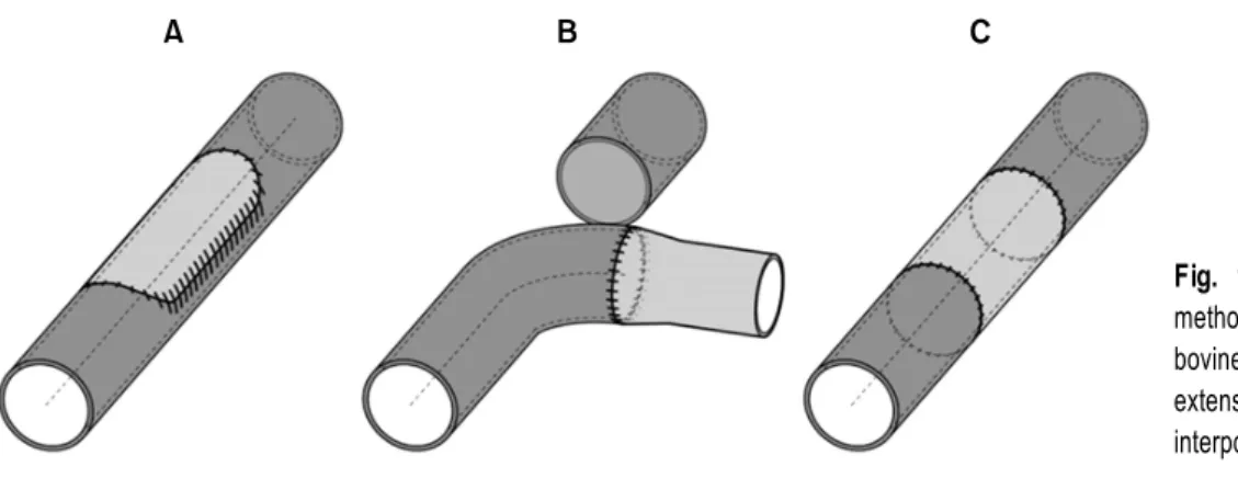 Fig. 1. Various surgical graft repair  methods. (A) Patch angioplasty with  bovine pericardium or graft; (B) graft  extension to new vein, and (C) graft  interposition.