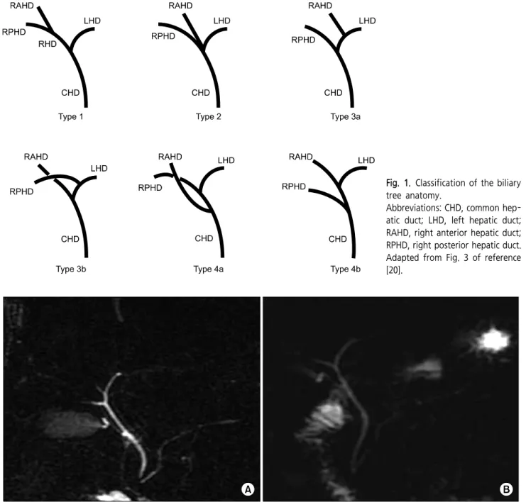 Fig. 1. Classification  of  the  biliary  tree  anatomy. 