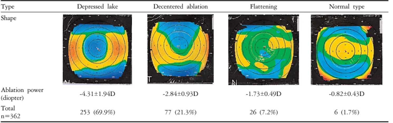 Fig. 3. Trend  line  about  the  0.5mm  radius  central  anterior  surface  elevation  (E)  and  ablation  power  of  refractive  surgery.