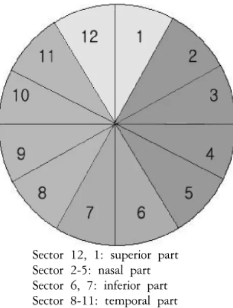 Table 2. Types  of  primary  angle-closure  glaucoma  and  the  prevalence  of  peripheral  anterior  synechiae