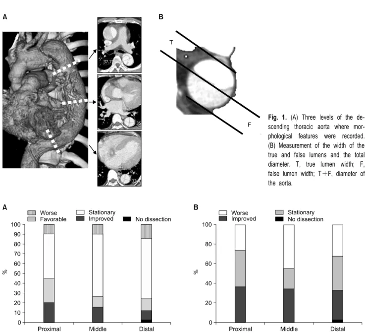 Fig. 1. (A) Three levels of the de- de-scending thoracic aorta where  mor-phological features were recorded