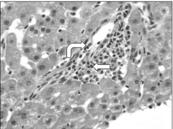 Fig. 1. Histologic  features of  morphologically severe preserva- preserva-tion  injury  simulating  AMR