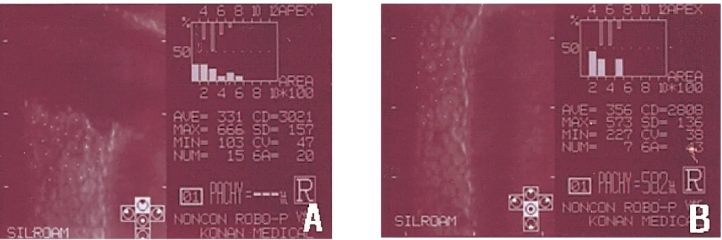Fig. 4. Specular  microscopy  at  the  site  of  Figure  2  (arrow,  A;  arrow  head,  B)  on  16  weeks  postoperatively