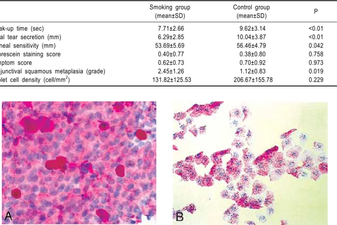 Fig. 1. Impression cytology (PAS, X400). (A) Specimen from a nonsmoker shows PAS positive goblet cells and small, round  epithelial cells with a nucleocytoplasmic ratio of 1:2