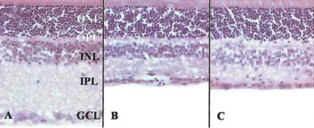 Fig. 1. Representative  photomicrographs  of  transverse  sections  in  rat  retina  at  3  days  after  KA  injection  using  H-E  staining